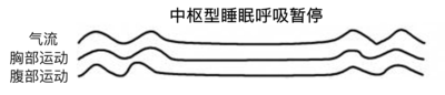 中枢型.png
